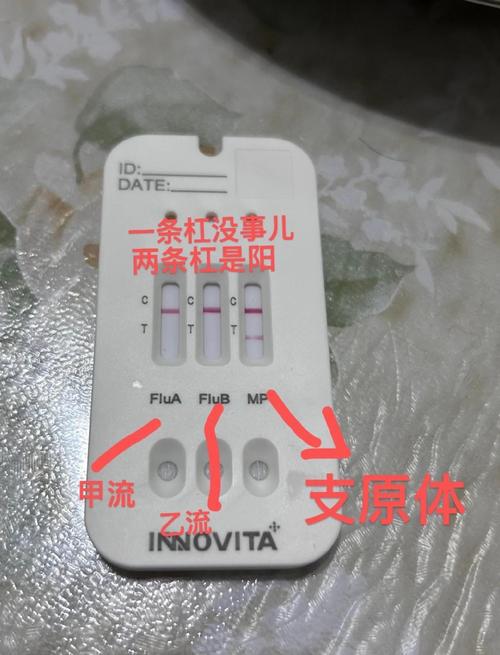 咽拭子阳性意味着什么？如何结合其他因素判断是否为病例？