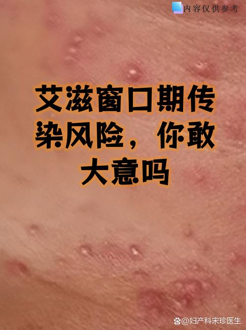 莆田疫情是德尔塔毒株吗？德尔塔病毒症状和预防措施